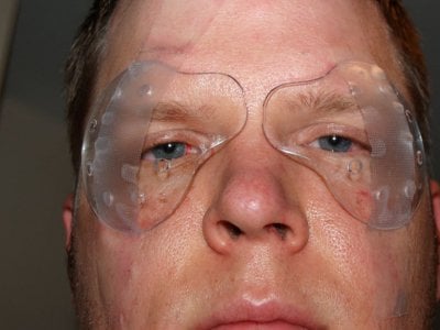Top 7 Best Las Vegas Nv Lasik Surgeons Angie S List