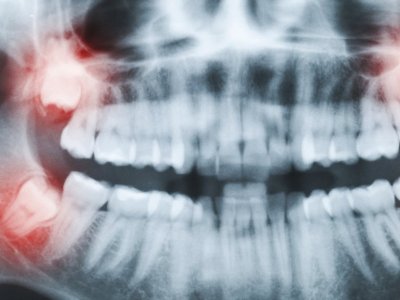 Top 10 Best Tampa Fl Dentists Angie S List