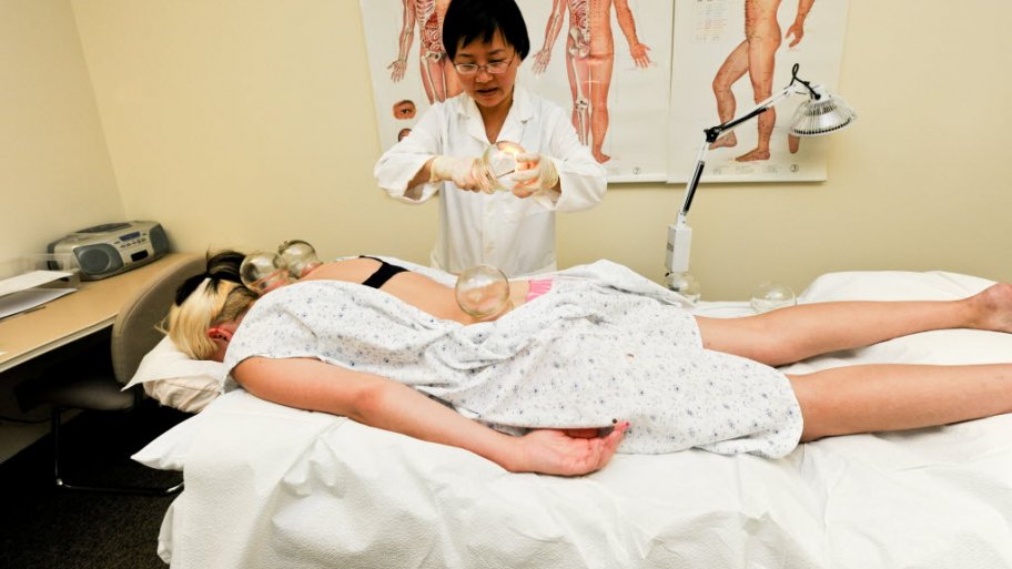 Cupping Therapy