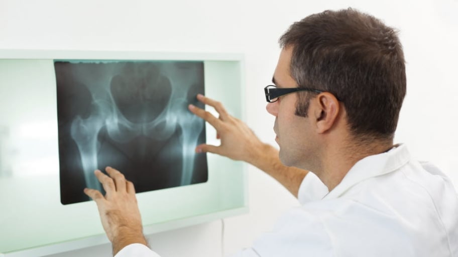 Hip X-Ray