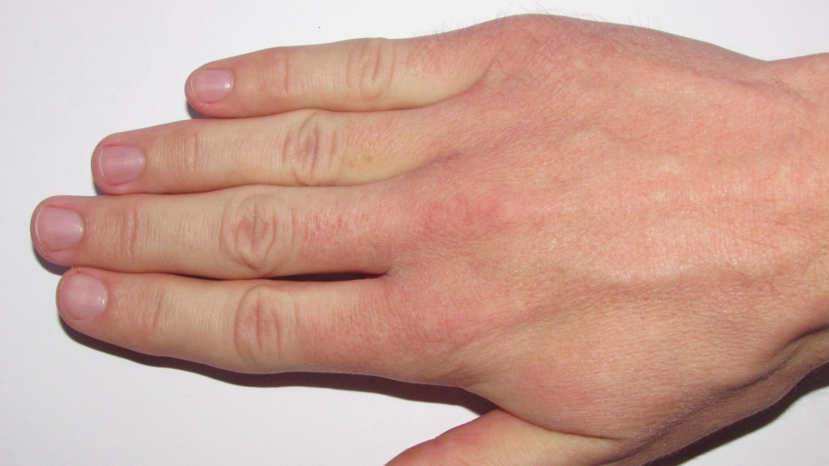 person's hand