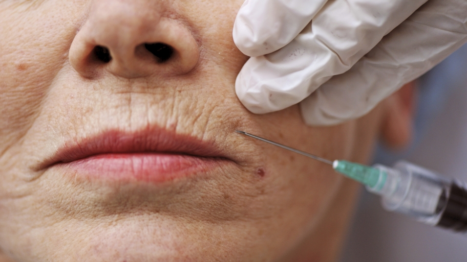 Can A Dermatologist Help My Skin Look Younger Angie S List