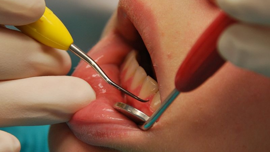 dentist examining patient