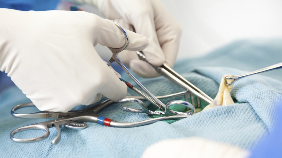 A surgeon removes an appendix.