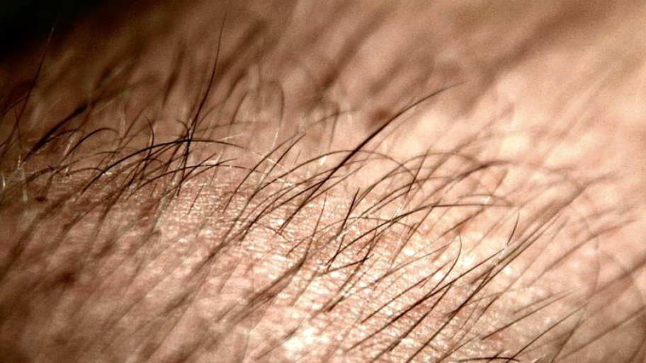 arm hair