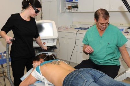 using laser to go over areas of tattoo to remove