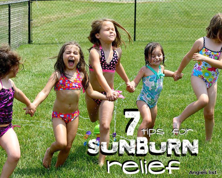 7 tips for sunburn relief 7 tips for sunburn relief